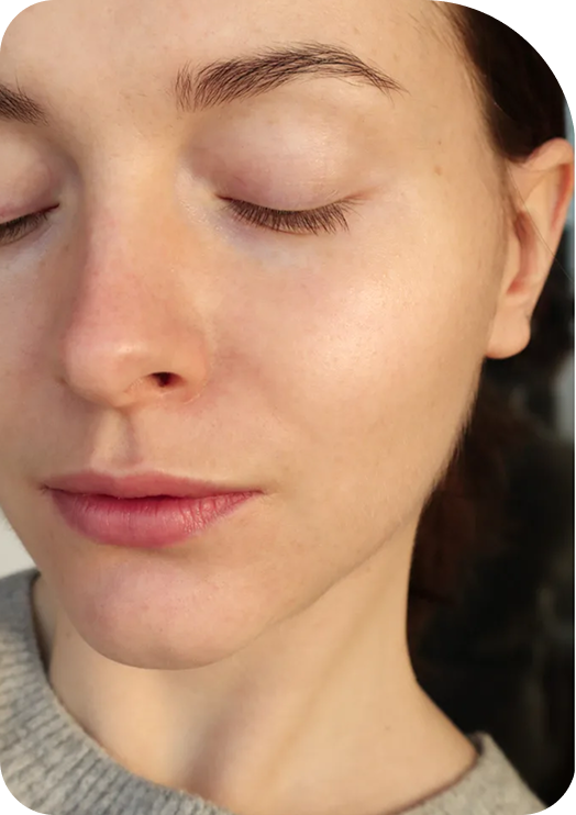 KESBIA skincare result before use